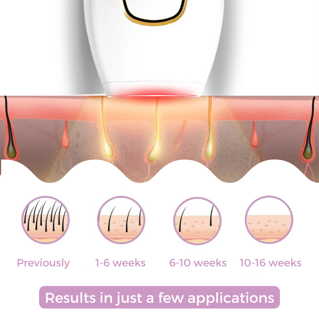 Mini Laser Hair Removal