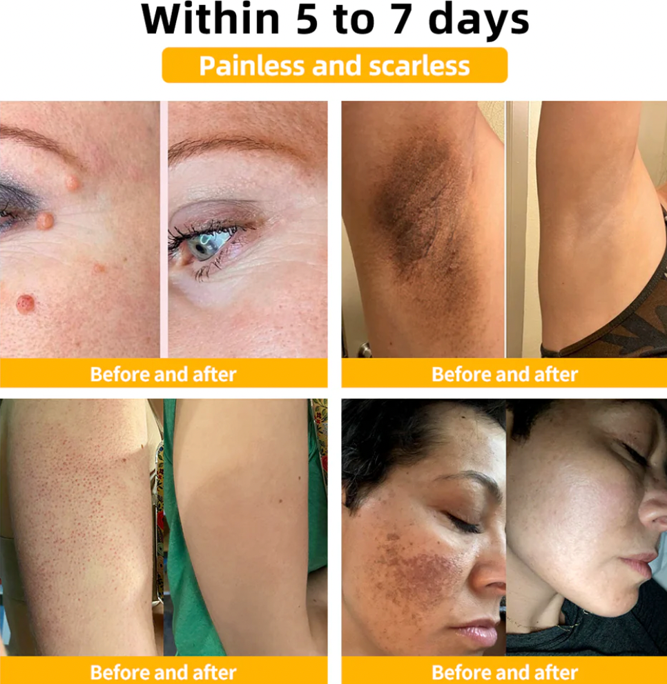 HOUKEA - Bee Venom Skin Care Cream (Original)