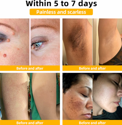 HOUKEA - Bee Venom Skin Care Cream (Original)