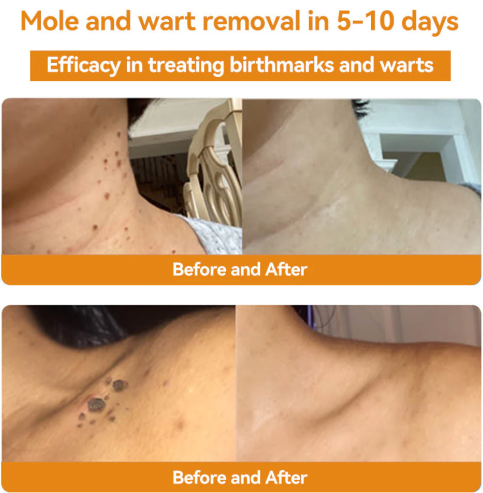 HOUKEA - Bee Venom Skin Care Cream (Original)