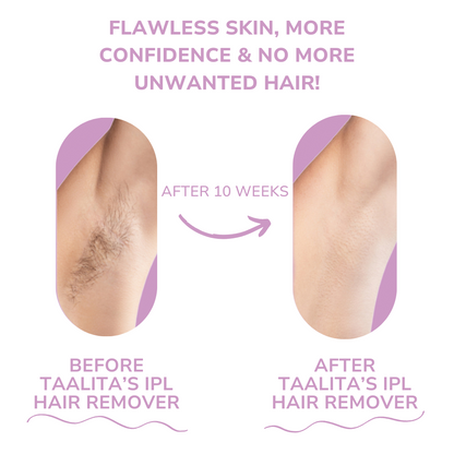 Mini Laser Hair Removal